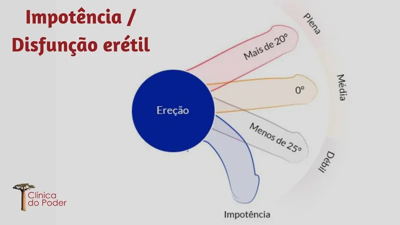 Impotência/Disfunção erétil -Dr. Jósé Pereira da Silva