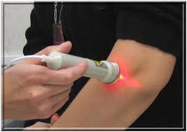 tratamento com laser